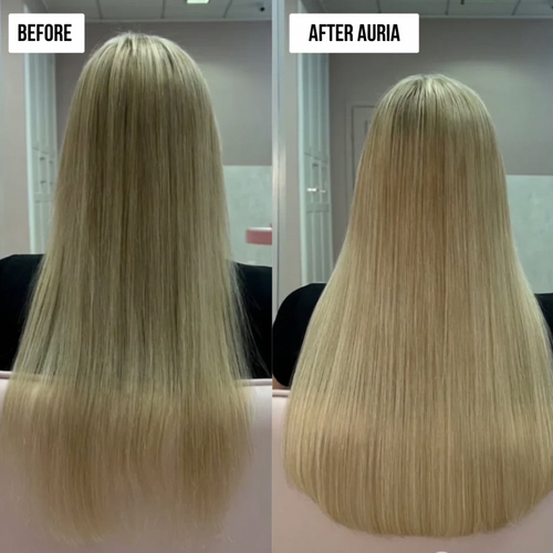 Auria Hair Regrowth System